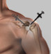 Arthroscopic - Shoulder & Elbow Clinic